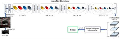 Using Deep Neural Network to Diagnose Thyroid Nodules on Ultrasound in Patients With Hashimoto’s Thyroiditis